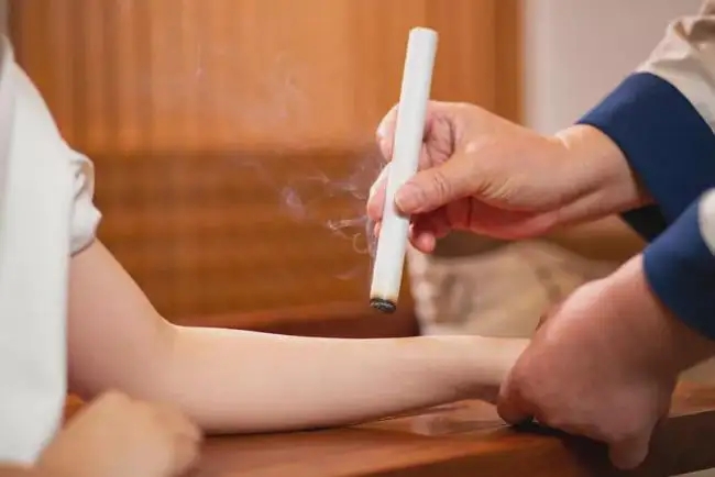 艾灸和拔罐的注意事項！